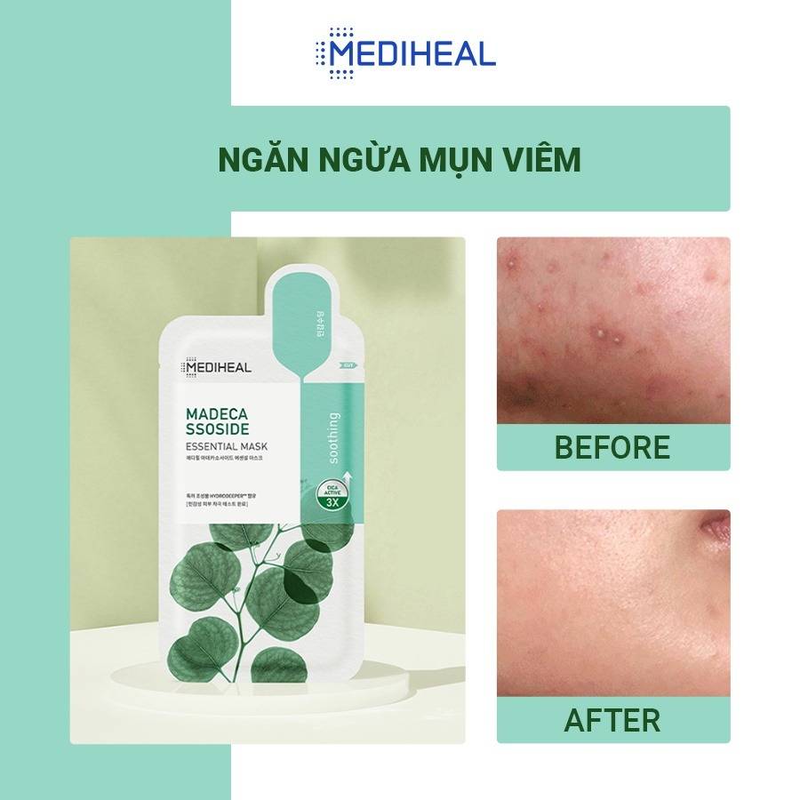 mat-na-giup-ngan-ngua-mun-viem-va-lam-diu-da-mediheal-madecassoside-essential-mask-chiet-xuat-rau-ma-24ml