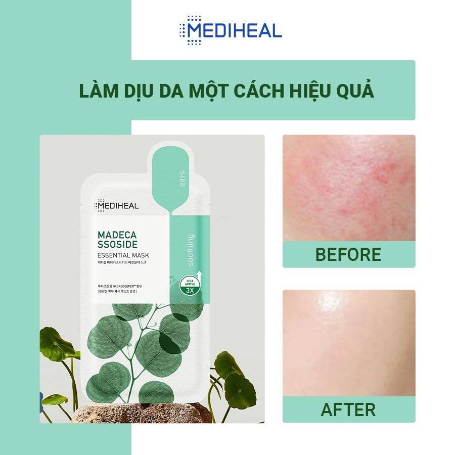 mat-na-giup-ngan-ngua-mun-viem-va-lam-diu-da-mediheal-madecassoside-essential-mask-chiet-xuat-rau-ma-24ml