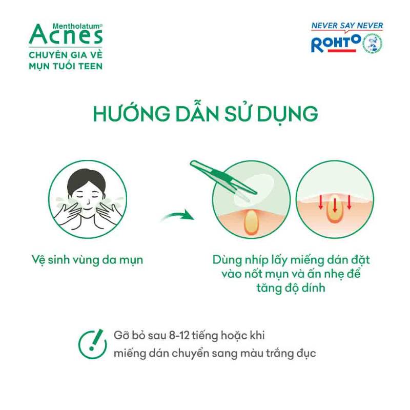 mieng-dan-mun-3-tac-dong-acnes-clear-patch-48-mieng