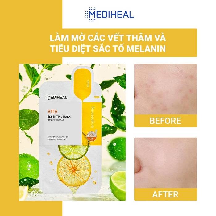 mat-na-co-chua-vitamin-lightbeam-giup-trang-sang-da-mediheal-vita-lightbeam-essential-mask-ex-24ml-x-1