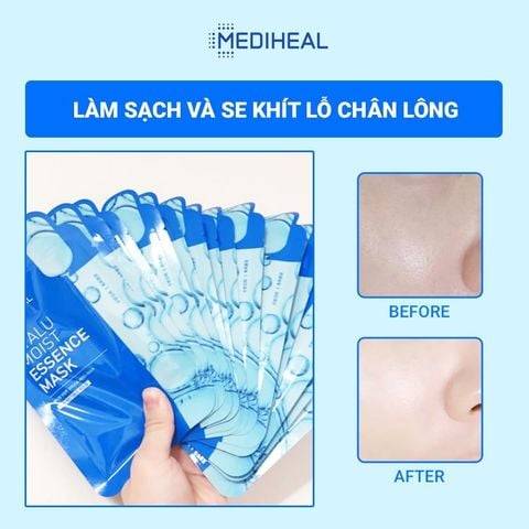 mat-na-duong-am-chuyen-sau-mediheal-hyalu-moist-essence-mask-20ml