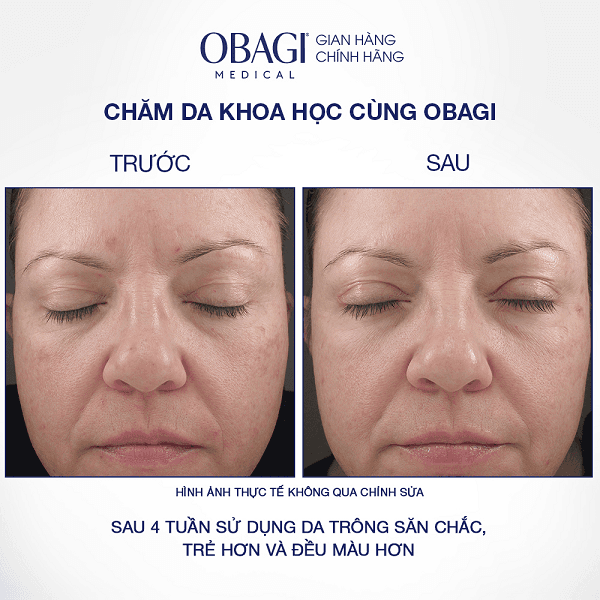 kem-duong-giup-lam-cham-qua-trinh-lao-hoa-va-tai-tao-da-obagi-retinol-1.0%-cream-5g