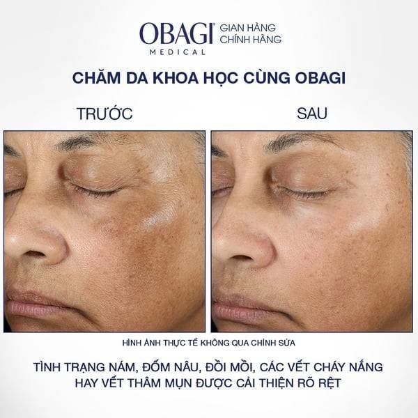 kem-duong-sang-da-&-mo-nam-obagi-nu-derm-blend-fx-57g