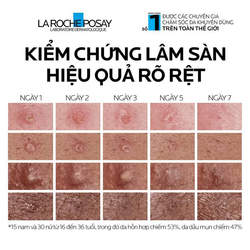 lrp-kem-duong-giam-mun-chi-sau-8h-effaclar-duo-m-40ml-cai-tien-moi