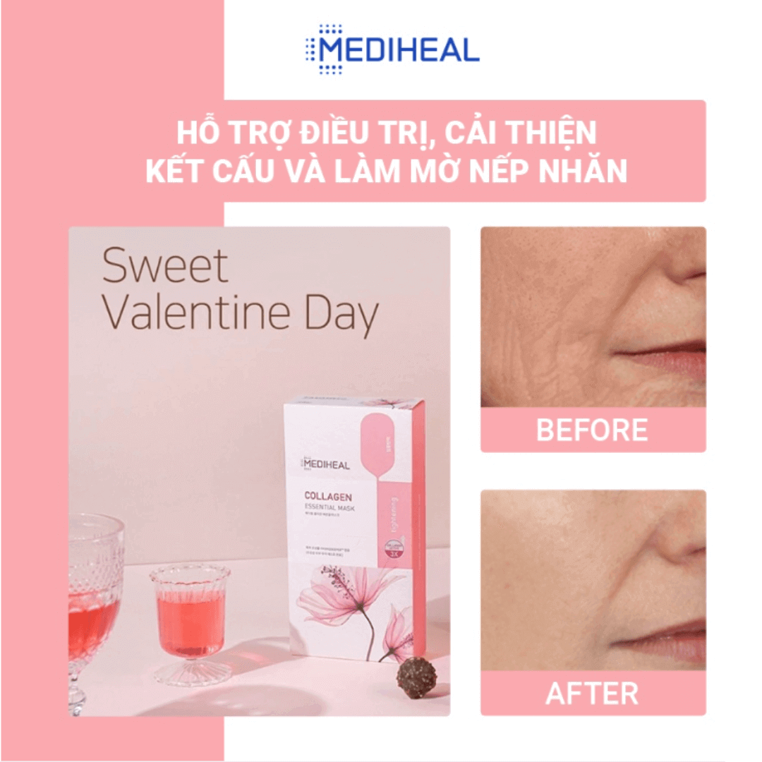 mat-na-collagen-ngan-ngua-lao-hoa-da-mediheal-collagen