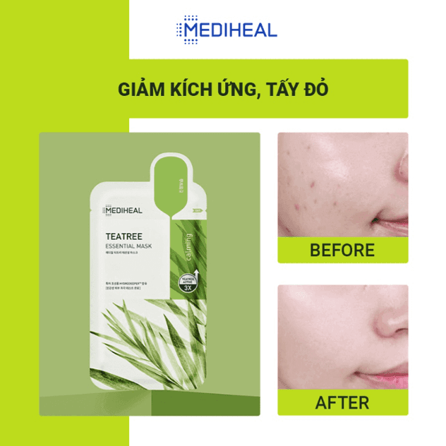 mat-na-chua-tinh-chat-tra-xanh-ngan-ngua-mun-mediheal-teatree-care-solution-essential-mask-ex-24ml