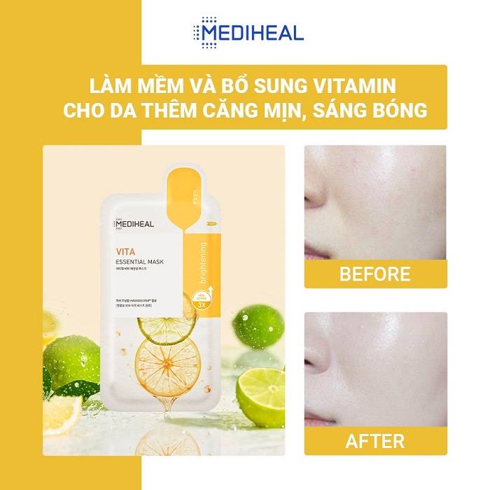 mat-na-co-chua-vitamin-lightbeam-giup-trang-sang-da-mediheal-vita-lightbeam-essential-mask-ex-24ml-x-1