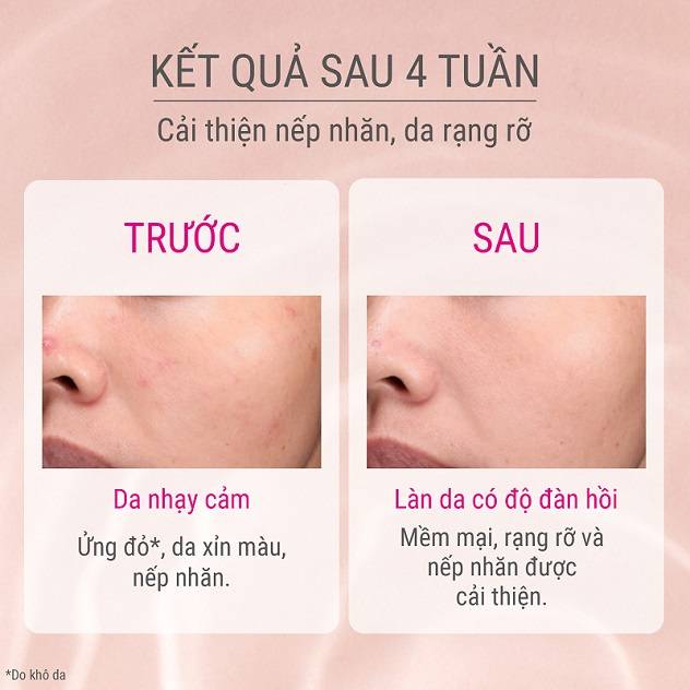 duong-chat-dprogram-giup-ho-tro-da-ngan-ngua-lao-hoa-som-45ml