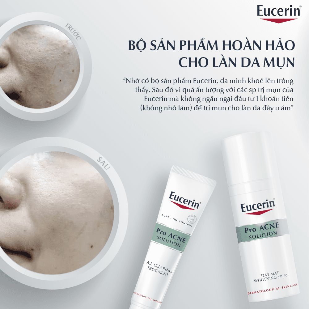 tinh-chat-tri-mun-mo-vet-tham-tai-tao-da-ngan-ngua-mun-eucerin